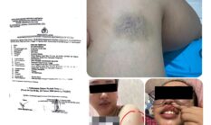 Perkara KDRT Mandek Sejak 2024, Kuasa Hukum Korban Soroti Kinerja Unit PPA Polres Tangerang Selatan