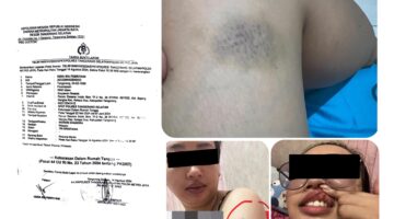 Perkara KDRT Mandek Sejak 2024, Kuasa Hukum Korban Soroti Kinerja Unit PPA Polres Tangerang Selatan