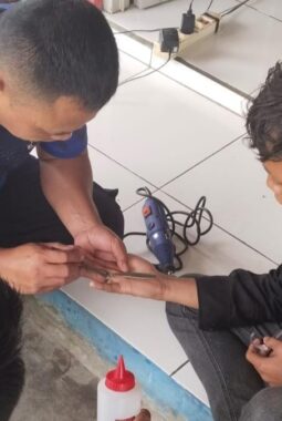 Detik-Detik Damkar Bungbulang Keluarkan Cincin di Jari Anak Yang Bengkak dari Mekarbakti