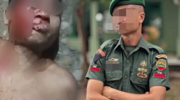 Kasus Dugaan Penganiayaan di Nias Selatan Dilaporkan ke Polisi, Libatkan Oknum TNI