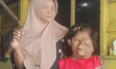 Mohon Bantuan ke Presiden RI Prabowo Subianto. Ibu & Anak Di Sragen Berjuang Melawan Kanker di Tengah Himpitan Ekonomi