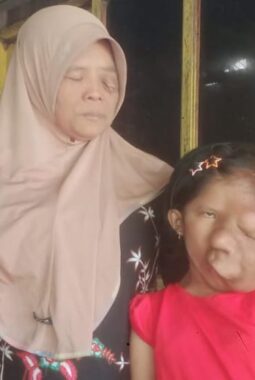 Mohon Bantuan ke Presiden RI Prabowo Subianto. Ibu & Anak Di Sragen Berjuang Melawan Kanker di Tengah Himpitan Ekonomi