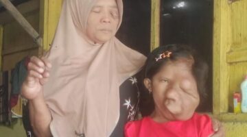 Mohon Bantuan ke Presiden RI Prabowo Subianto. Ibu & Anak Di Sragen Berjuang Melawan Kanker di Tengah Himpitan Ekonomi