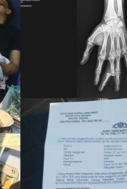 Diduga Menjadi Korban Kekerasan Bersenjata Tajam, Anak Jurnalis di Cirebon Belum Peroleh Kepastian Hukum