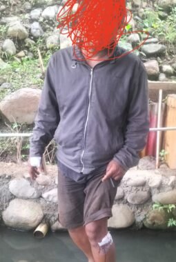 Sukono Warga Kelurahan Mersi Purwokerto Timur Jadi Korban Penusukan dirumahnya Sendiri
